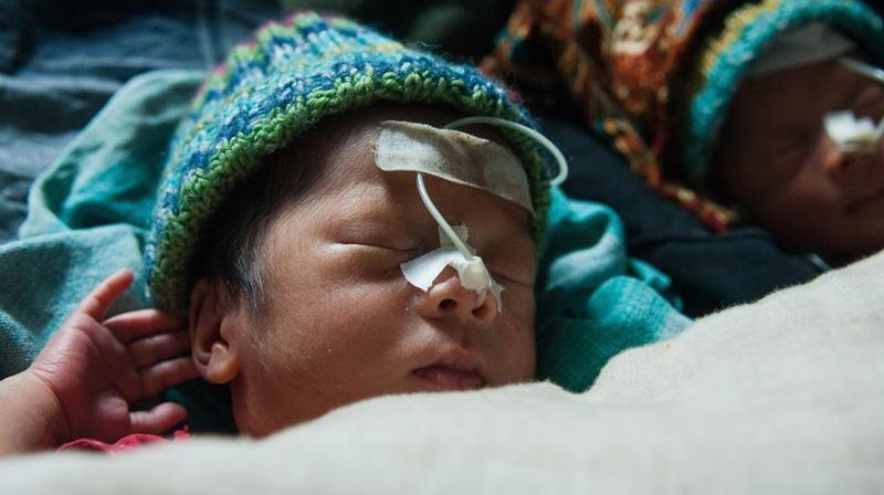 Sykeshuset har over 800 fødsler i året, og tilbyr gratis behandling for de minste. Foto: Normisjon.no